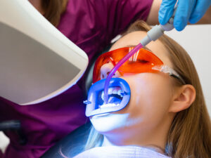 clareamento dental