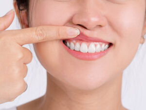 periodontia