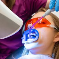 clareamento dental