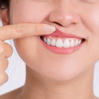 periodontia